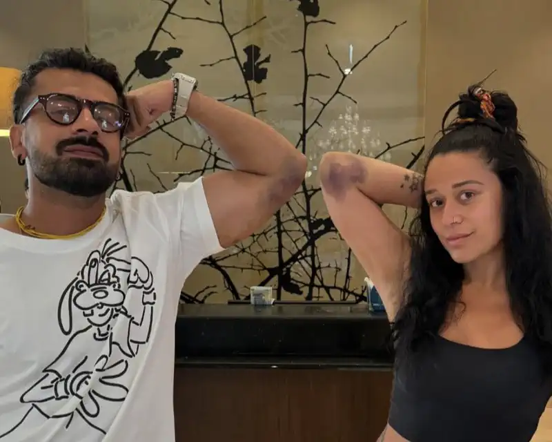Krishna Shroff Proudly Displays Severe Elbow Bruise from Khatron Ke Khiladi Stunt